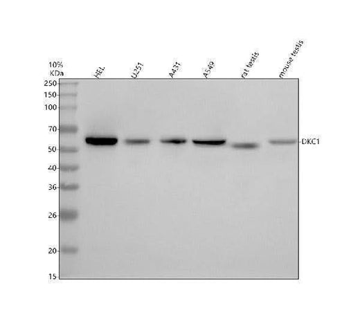 Anti-DKC1 Antibody Picoband® Boster Bio