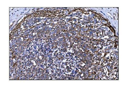 Anti-TLR8 Antibody Boster Bio