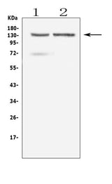 Anti-RTEL1 Antibody Picoband® Boster Bio