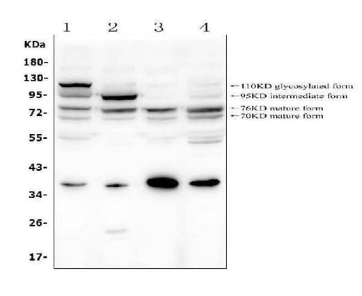Anti-GAA Antibody Picoband® Boster Bio
