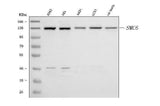 Anti-SMC6 Antibody Picoband® Boster Bio