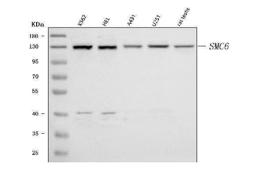 Anti-SMC6 Antibody Picoband® Boster Bio