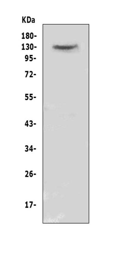 Anti-CACNA2D2 Antibody Picoband® Boster Bio