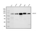 Anti-BubR1/BUB1B Antibody Picoband® Boster Bio