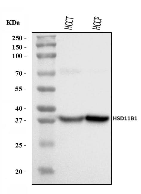 Anti-HSD11B1 Antibody Picoband® Boster Bio