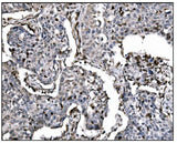 Anti-Fos B/FOSB Antibody Boster Bio