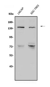 Anti-N-Cadherin-2 CDH2 CD325-Antibody Picoband® Boster Bio