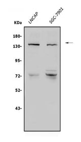 Anti-N-Cadherin-2 CDH2 CD325-Antibody Picoband® Boster Bio
