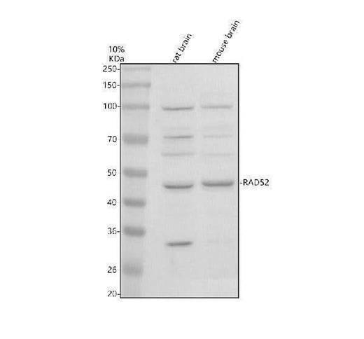 Anti-RAD52 Antibody Picoband® Boster Bio