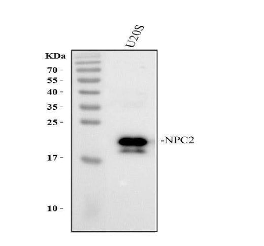 Anti-Niemann Pick C2/NPC2 Antibody Picoband® Boster Bio