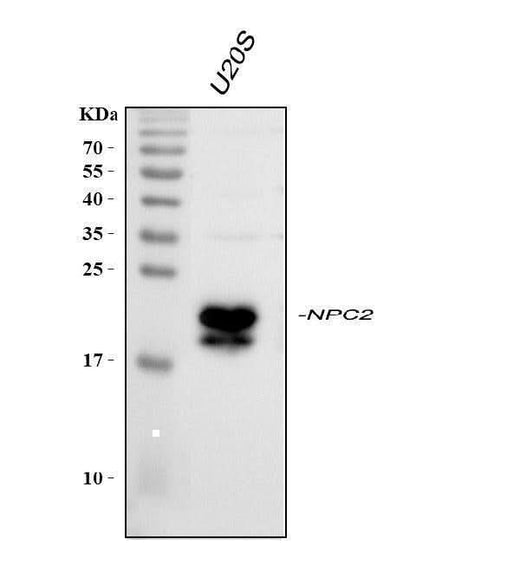 Anti-Niemann Pick C2/NPC2 Picoband® Antibody Boster Bio