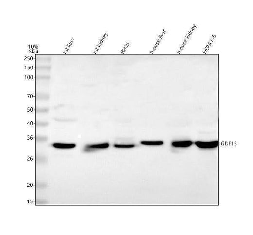 Anti-Gdf15 Antibody Picoband® Boster Bio