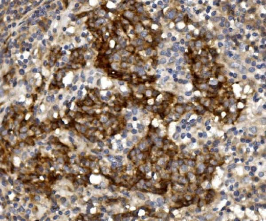 Anti-Claudin 1/CLDN1 Antibody Boster Bio