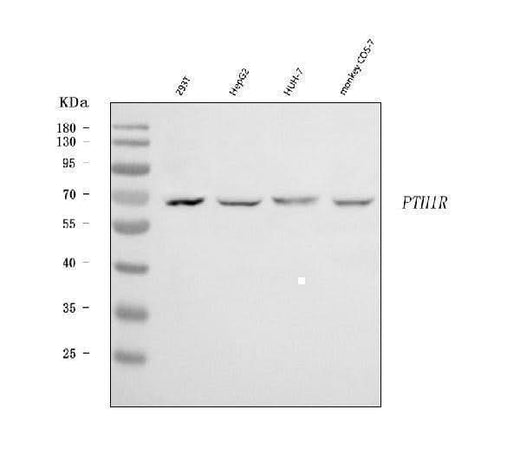 Anti-Parathyroid Hormone Receptor 1/PTH1R Antibody Picoband® Boster Bio