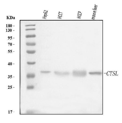 Anti-Cathepsin L/MEP/CTSL Antibody Picoband® Boster Bio