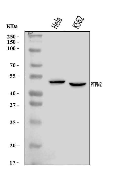 Anti-TCPTP/PTPN2 Antibody Picoband® Boster Bio