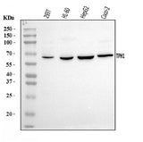 Anti-Tryptophan Hydroxylase/TPH1 Antibody Picoband® Boster Bio