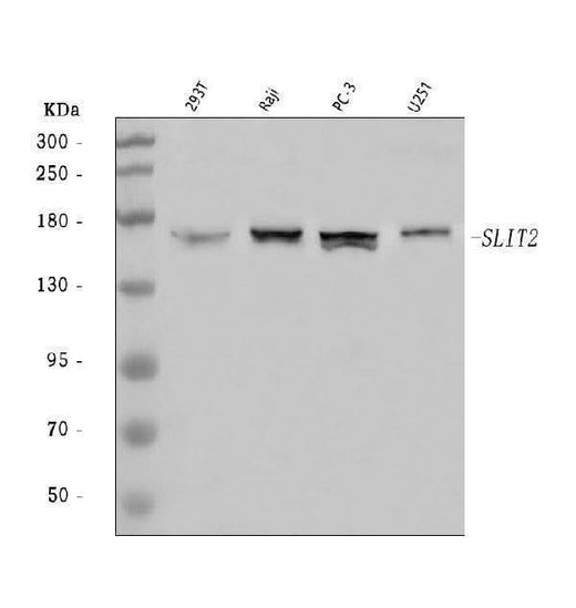 Anti-SLIT2 Antibody Picoband® Boster Bio