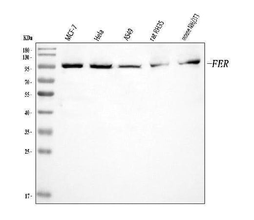 Anti-FER Antibody Picoband® Boster Bio