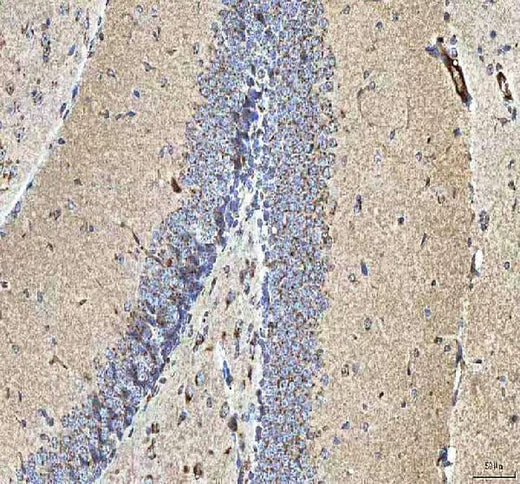 Anti-HCRT Antibody Boster Bio