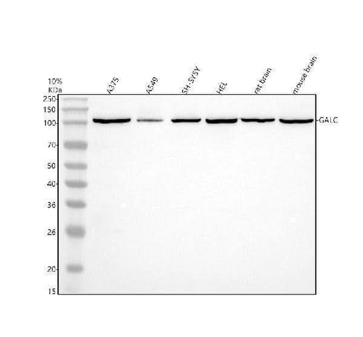 Anti-GALC Antibody Picoband® Boster Bio