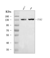 Anti-TYK2 Antibody Picoband® Boster Bio