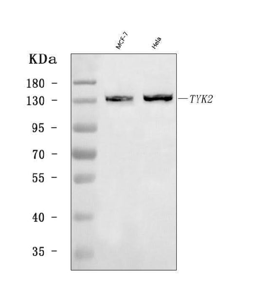 Anti-TYK2 Antibody Picoband® Boster Bio
