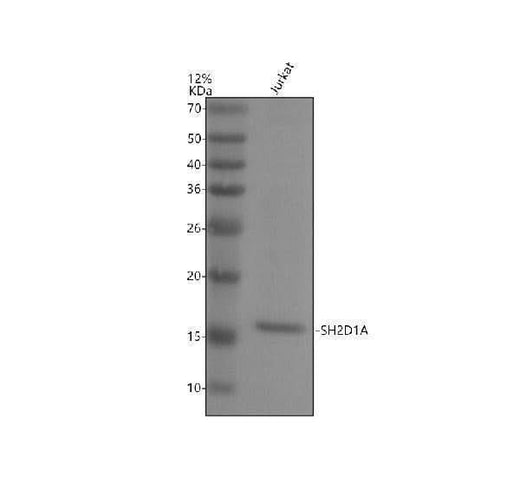 Anti-SH2D1A Antibody Picoband® Boster Bio