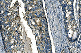 Anti-FGF4 Antibody Boster Bio