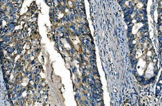 Anti-FGF4 Antibody Boster Bio