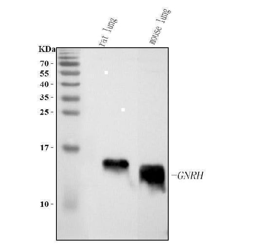 Anti-GHRH Antibody Picoband® Boster Bio