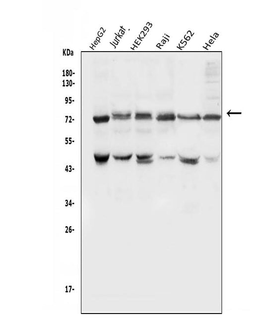 Anti-E3 SUMO-protein ligase PIAS1 PIAS1 Antibody Picoband® Boster Bio