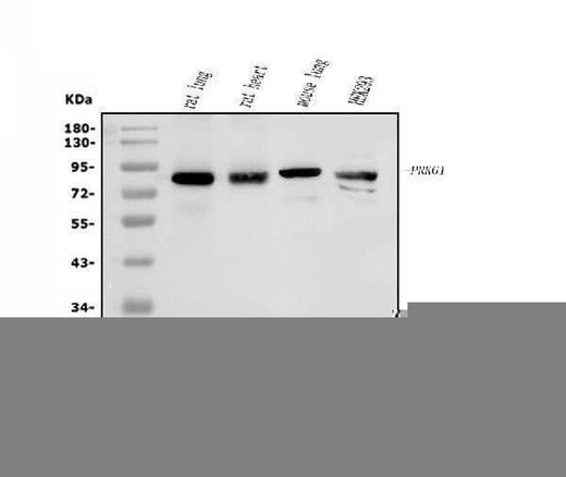 Anti-cGKI/PRKG1 Antibody Picoband® Boster Bio