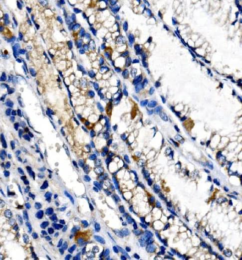 Anti-Ghrelin/GHRL Antibody Boster Bio