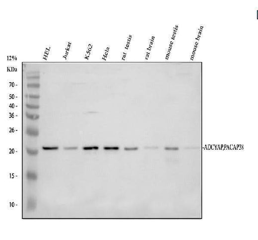 Anti-PACAP-38/ADCYAP1 Antibody Picoband® Boster Bio