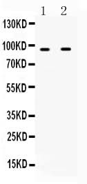 Anti-IFNGR1 Antibody Picoband® Boster Bio