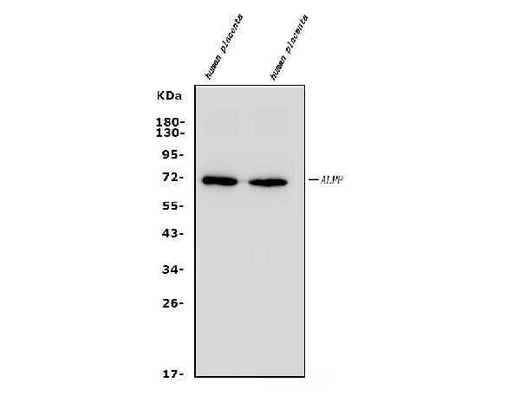 Anti-Placental alkaline phosphatase (PLAP)/ALPP Antibody Picoband® Boster Bio