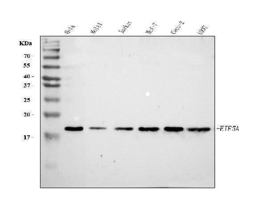 Anti-EIF5A Antibody Picoband® Boster Bio