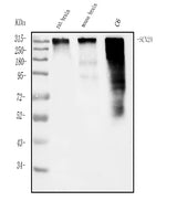 Anti-SCN2A Antibody Picoband® Boster Bio