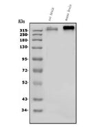 Anti-Scn2a Antibody Picoband® Boster Bio