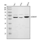 Anti-Liver Carboxylesterase 1/CES1 Antibody Picoband® Boster Bio
