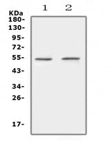 Anti-Protein C/PROC Antibody Picoband® Boster Bio