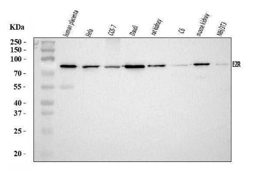 Anti-Ezrin/EZR Antibody Picoband® Boster Bio