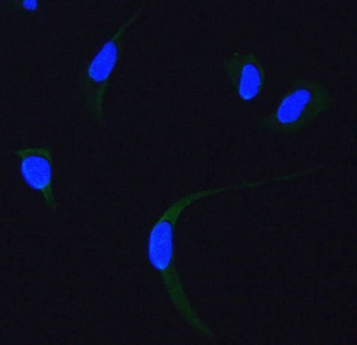 Anti-SDHA Antibody Picoband® Boster Bio