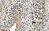 Anti-COL4A3 Antibody Boster Bio