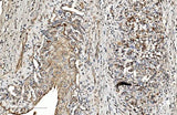 Anti-COL4A3 Antibody Boster Bio