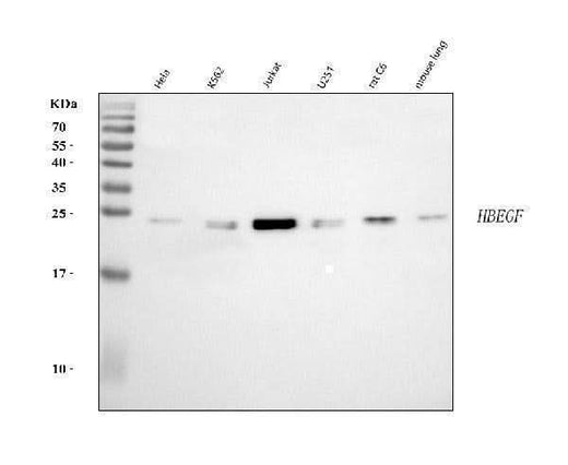 Anti-DTR/HBEGF Antibody Picoband® Boster Bio