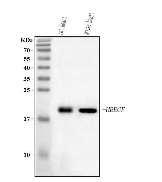 Anti-Hbegf Antibody Picoband® Boster Bio