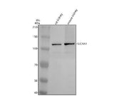 Anti-SLC4A4 Antibody Picoband® Boster Bio