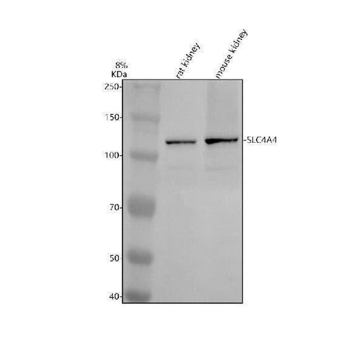 Anti-SLC4A4 Antibody Picoband® Boster Bio